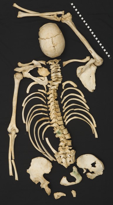 A skeleton laid out - Bristol Museums